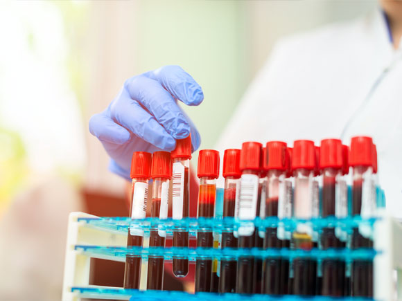 Developing Practical Sample Collection Solutions