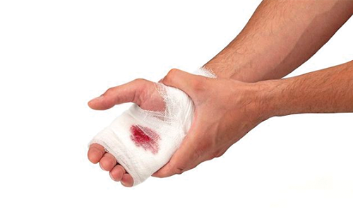 Hand With Medical Tape
