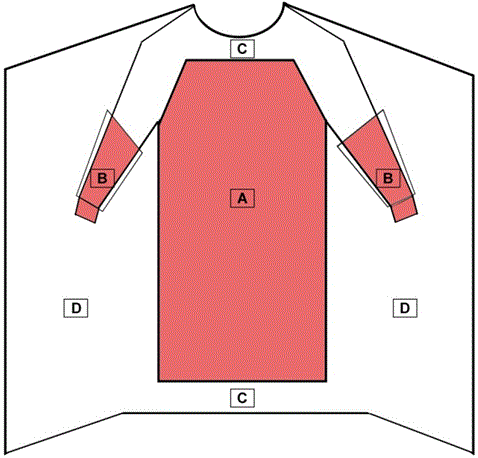 Critical Zones for Surgical Gowns